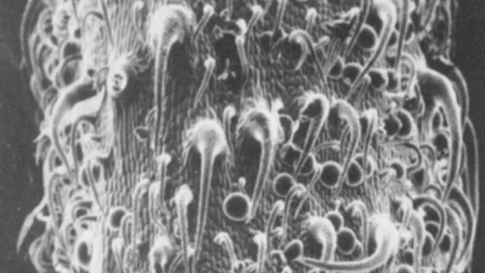 Lobe of a young cannabis leaf under microscope