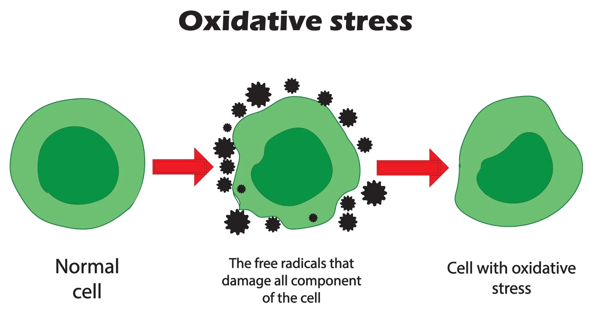 oxidative stress explained