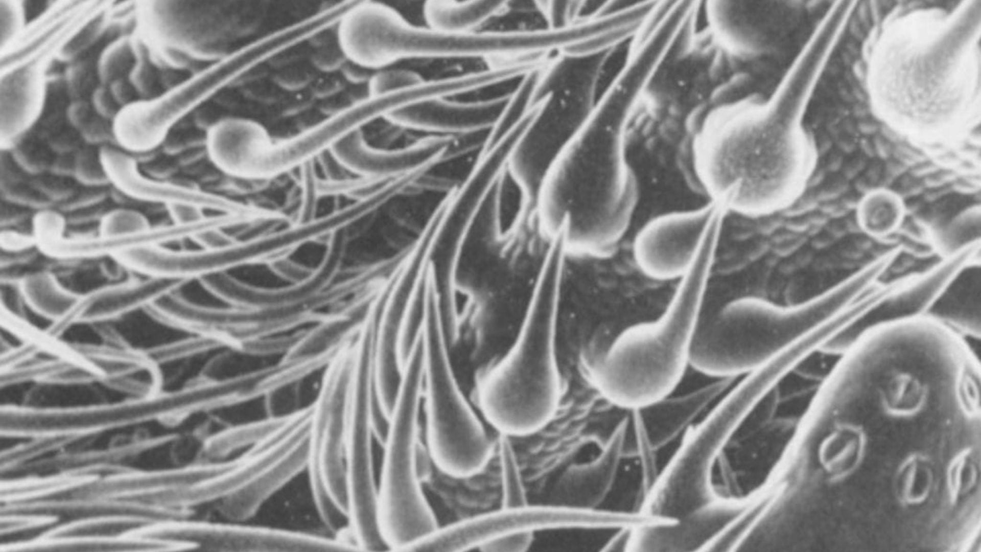 Triochomes under microscope 1976