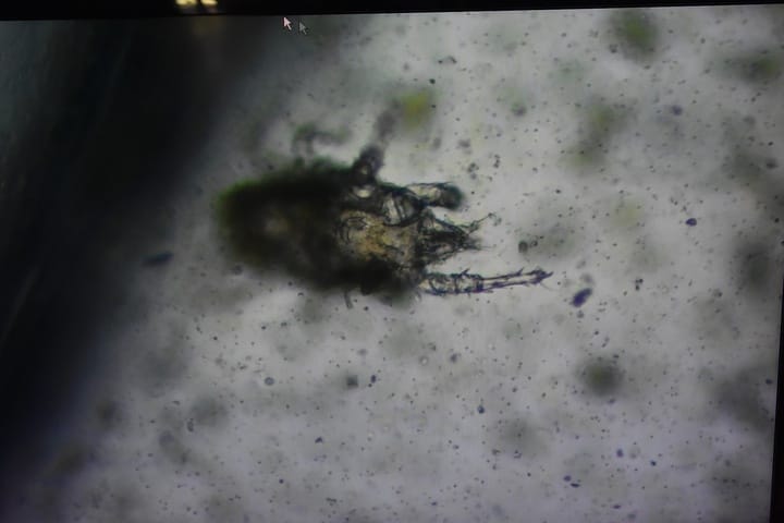 how do microbes help cannabis soil