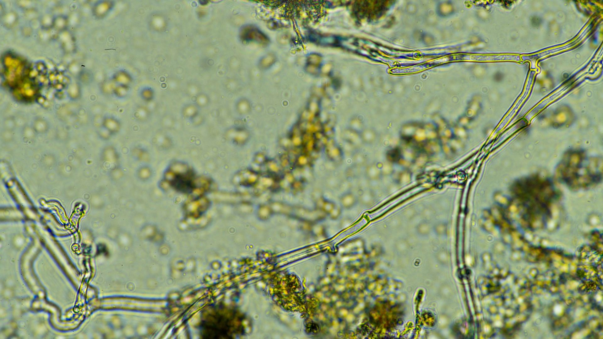 soil microbes cannabis