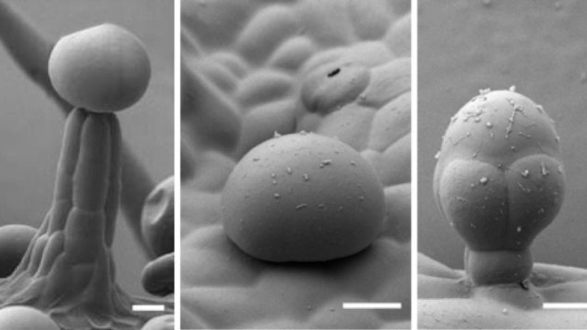 stalked, sessile, and bulbous trichomes under microscope